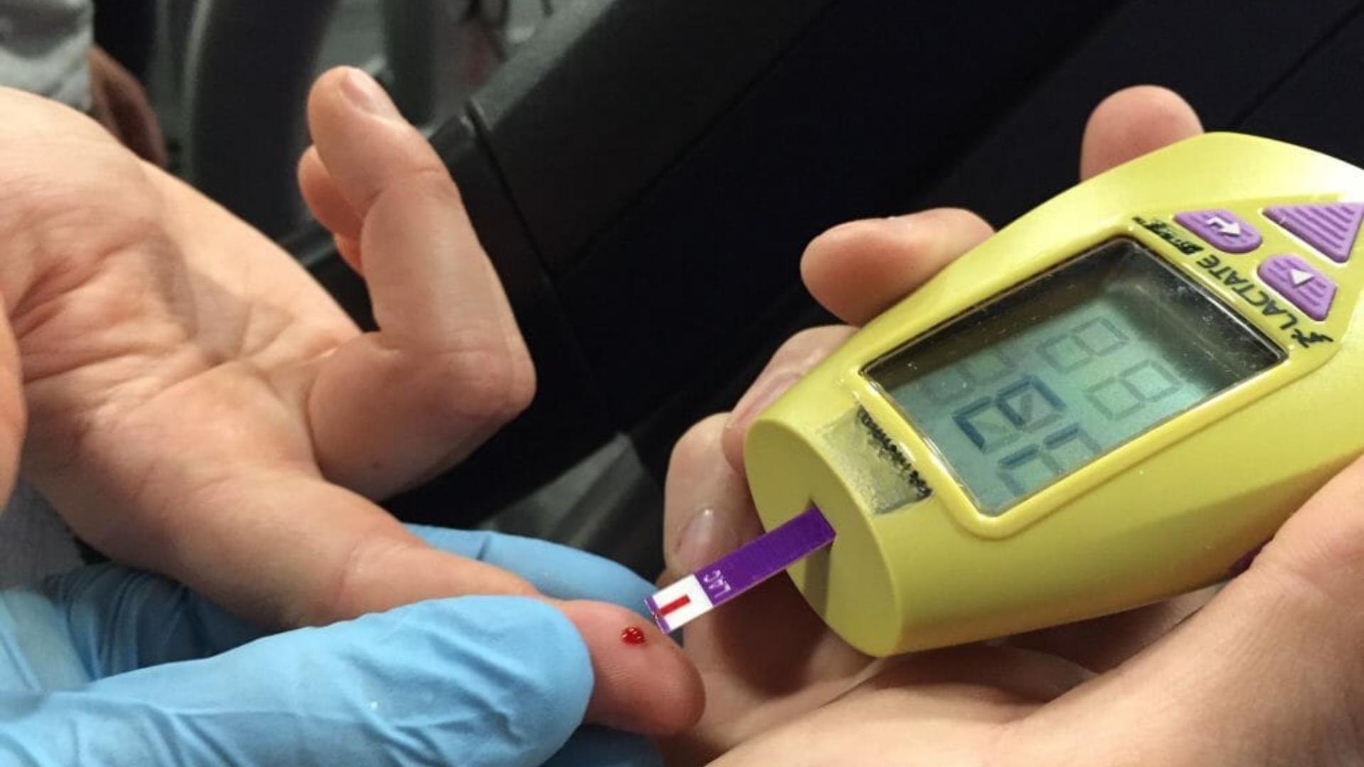 Traditional lactate testing with finger prick