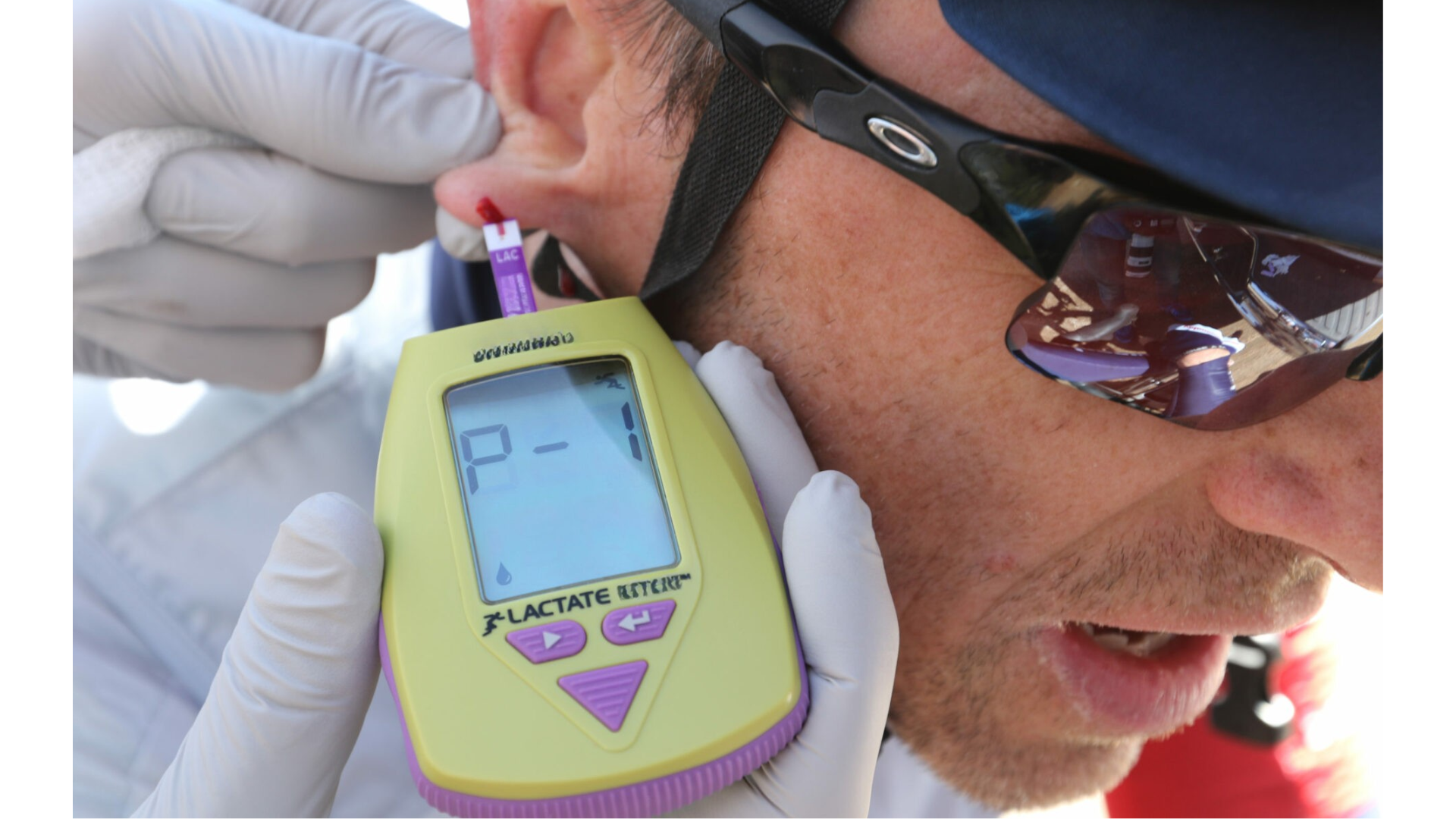 Painful finger prick lactate testing